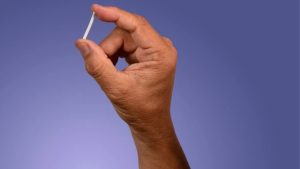 SUS oferecerá implante contraceptivo Implanon a partir do segundo semestre