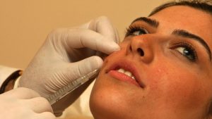 Anvisa mantém restrições do uso de PMMA como preenchedor estético