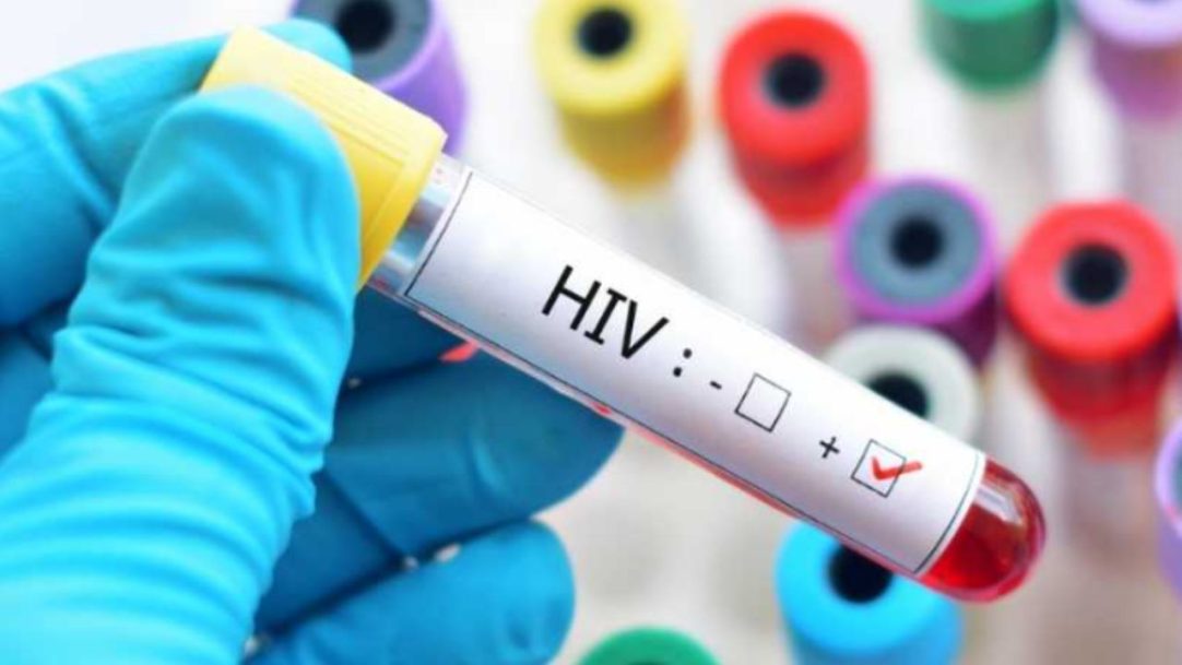 HIV: tecnologia RNAm usada na covid-19 pode ajudar pessoas soropositivas