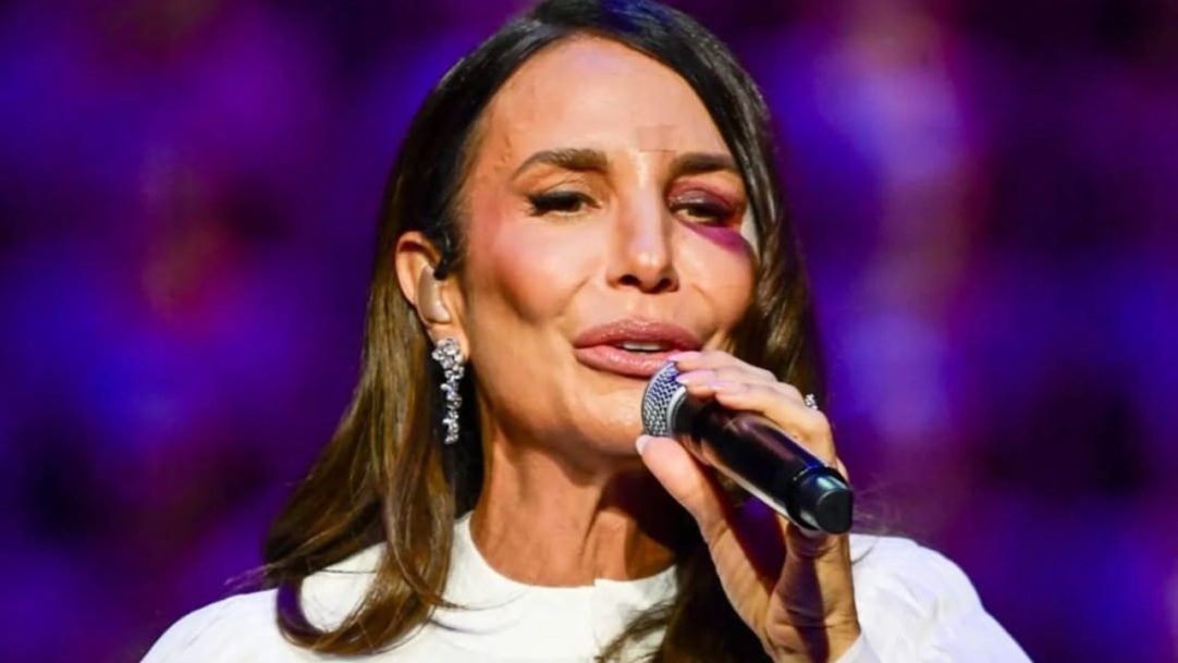 Ivete Sangalo continua agenda de shows após acidente e exibe hematoma
