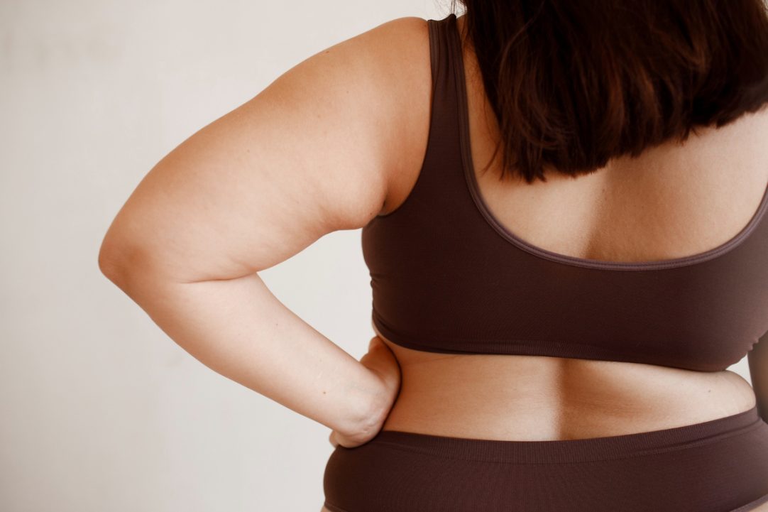 Canetas emagrecedoras não substituem cirurgia bariátrica