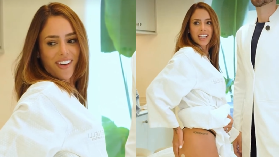 A imagem apresenta uma montagem com duas fotos em plano médio da influenciadora Bruna Biancardi dentro de um consultório estético iluminado, decorado com plantas verdes ao fundo. Em ambos os registros, ela veste um roupão felpudo branco e exibe cabelos castanhos com luzes, que estão soltos. Na foto à esquerda, Bruna aparece de perfil, sorrindo enquanto olha para trás sobre o ombro esquerdo. Já na imagem à direita, a influenciadora está de pé e posicionada de costas para a câmera, mas mantém o rosto virado para trás com uma expressão de surpresa positiva. Nesse momento, ela levanta levemente a lateral do roupão para observar o resultado do procedimento, deixando à mostra a parte superior da coxa e do glúteo direito, onde é possível ver uma pequena tatuagem em algarismos romanos. Ao seu lado, aparece parcialmente o corpo de um profissional vestindo um jaleco branco.