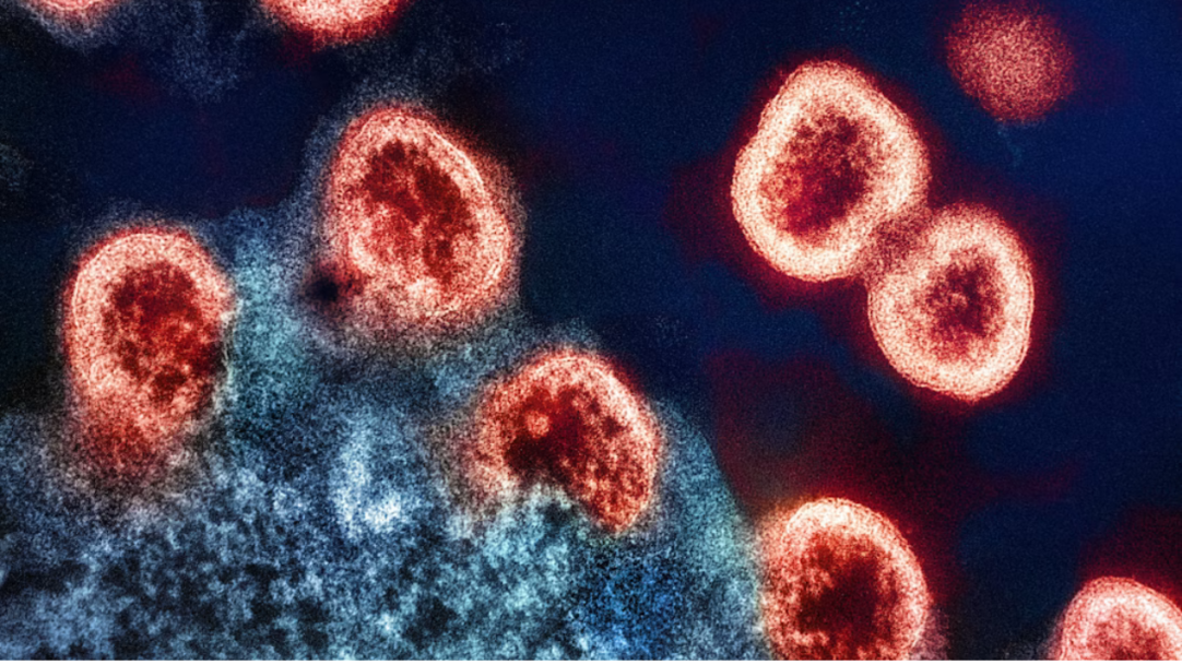 Treze pacientes agora vivem sem HIV detectável após transplantes de células-tronco