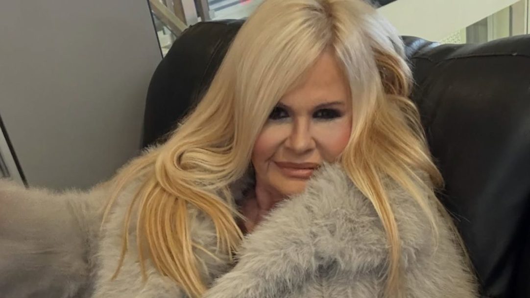 Monique Evans exibe resultado de cirurgia plástica e reage: “Chocada com a minha cara”