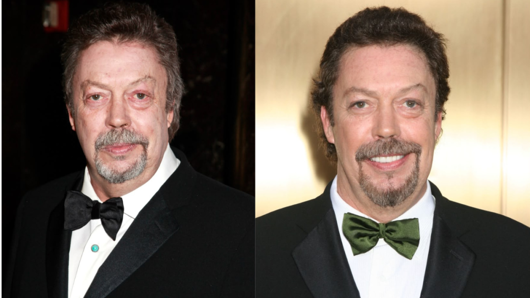 Tim Curry, de “IT”, precisou passar por cirurgia no crânio após sofrer um derrame