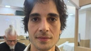 Fiuk choca os internautas ao surgir após procedimento de harmonização facial; confira o antes e depois