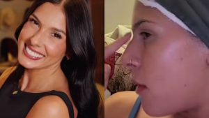 Ana Castela descarta colocar silicone, mas planeja cirurgia no nariz: ‘Esse quebra-mola’