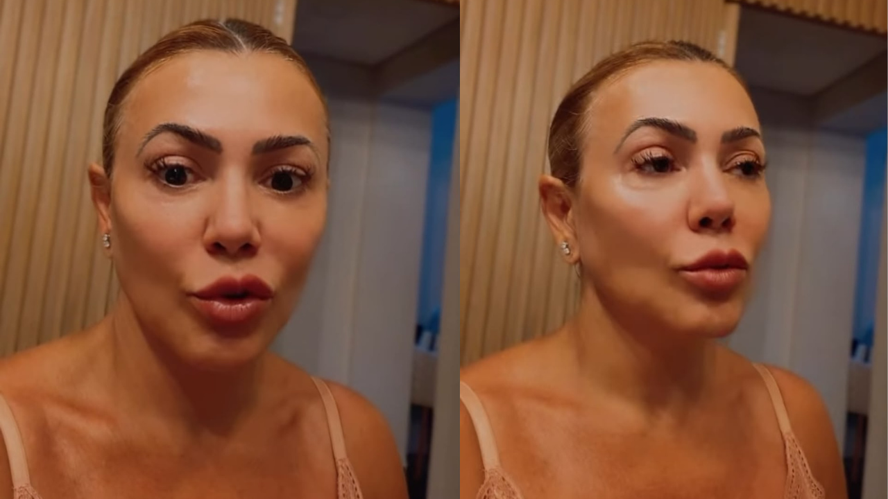 Ex-BBB Fabiana Teixeira revela reação ao descobrir cisto no cérebro: “Entrei em pânico”
