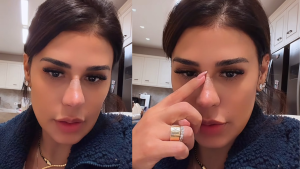 Após comentários sobre aparência, Simone Mendes esclarece procedimento no nariz: “Não é cirurgia”