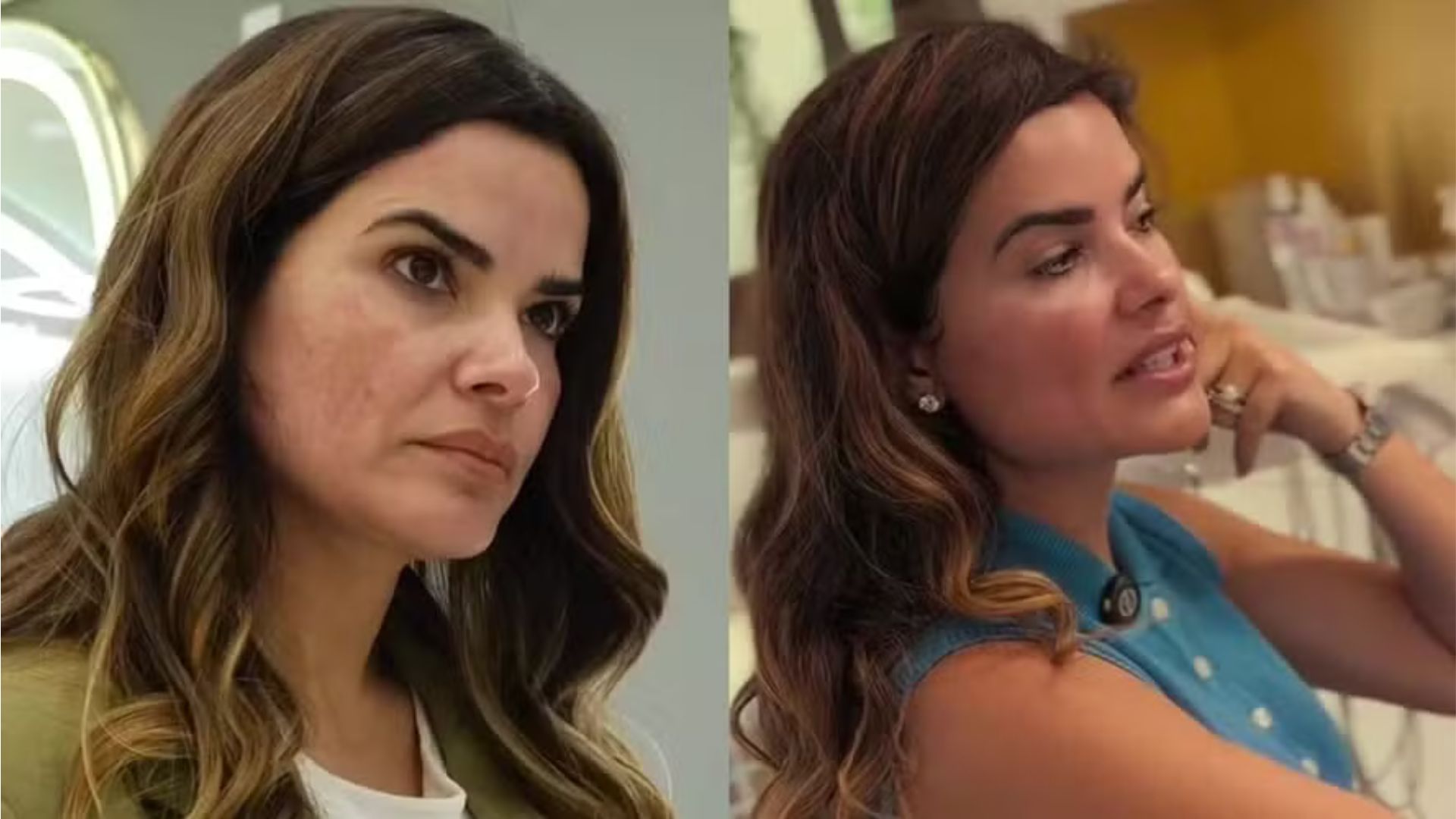 Vanessa Giácomo exibe resultado de procedimento para renovar o rosto e diverte fãs: “Estou insuportável”